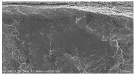 圖11-154 斷面A1、A2區(qū)邊沿微觀形貌